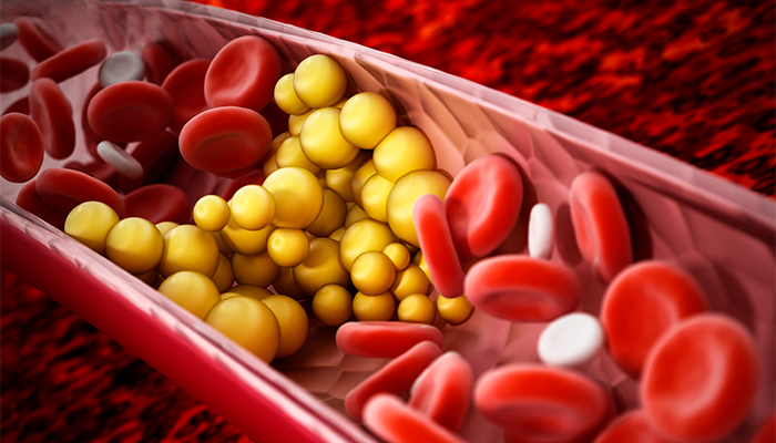 Fotografía para artículo de blog topfarma sobre realizarnos la prueba de triglicéridos en farmacias.